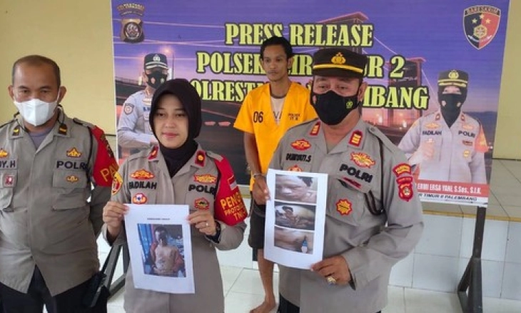 Sempat Buron 2 Tahun, Pelaku Penyiram Air Keras Hingga Korban Buta Mata Kirinya Diringkus