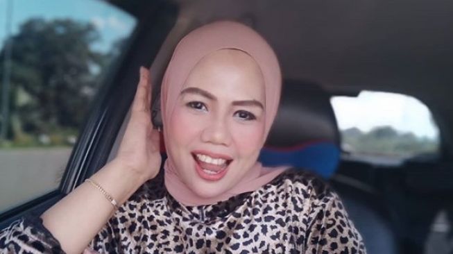  Penampilan Elly Sugigi Makin Kinclong Rela Potong Gigi dan Tanam benang di Pipi