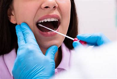 Ketua Satgas Covid-19 PB IDI Ingatkan Ledakan Kasus Usai PON