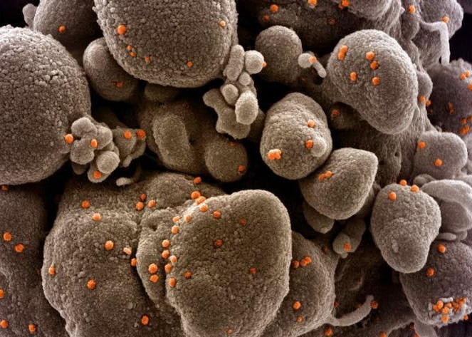 Ada 59 Kasus Positif Covid-19 di PON XX Papua, 10 Sembuh