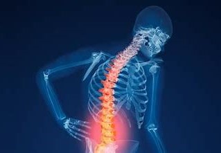 Waspada Osteoporosis Mulai Intai Usia Muda