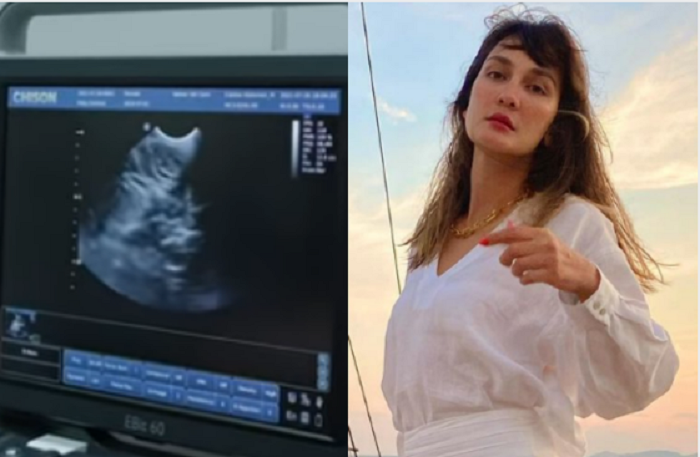 Luna Maya Ke RS Cek Kandungan 