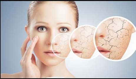 Inilah Bahan Alami Ampuh Atasi Kulit Wajah Kering