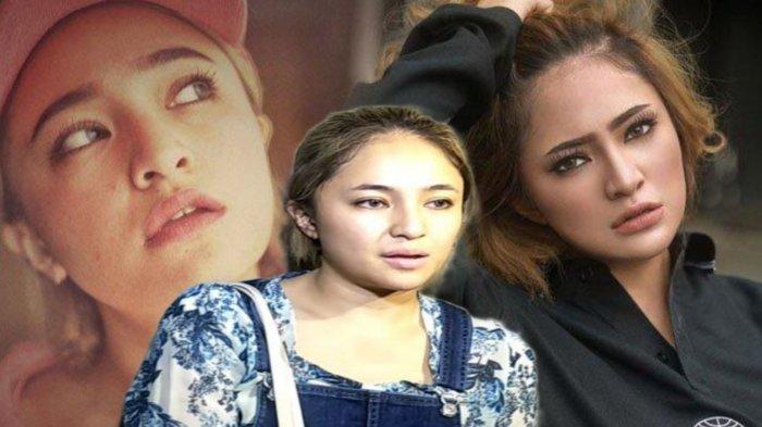 Cerita Marshanda Terapi Ketamin di Amerika, Dirinya Diberi Obat Bius Kuda