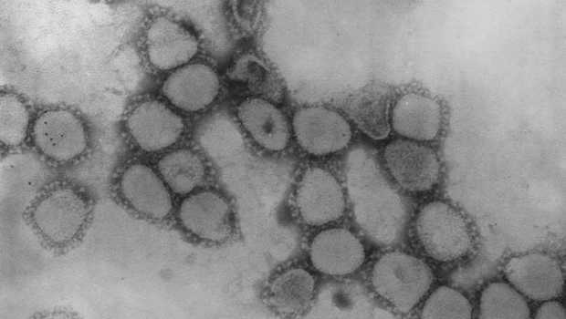 Peneliti: Covid-19 Telah Mengakhiri Musim Flu Musiman