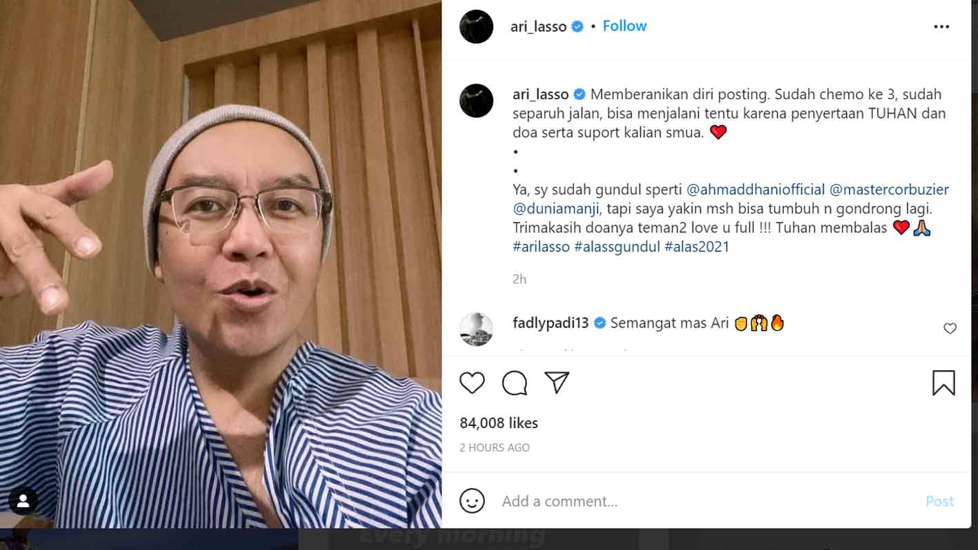 Ari Lasso Jalani Kemoterapi Tiga Kali dan Gundul Seperti Ahmad Dhani