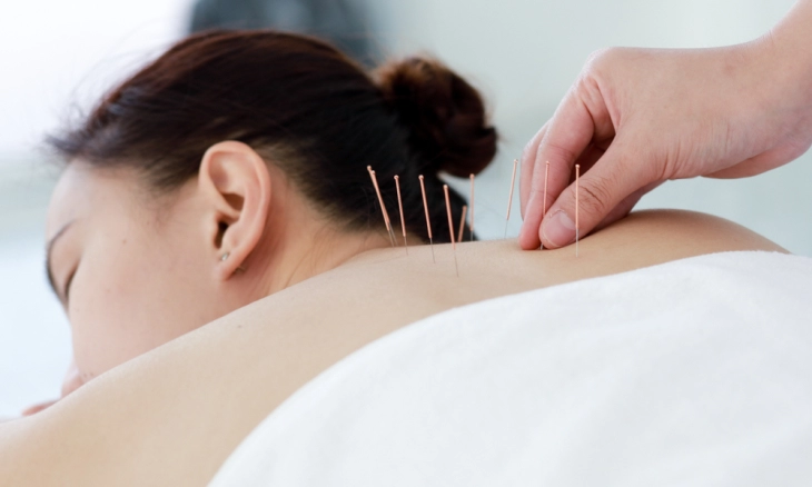 Bisakah Terapi Akupunktur Membantu Melawan Diabetes?