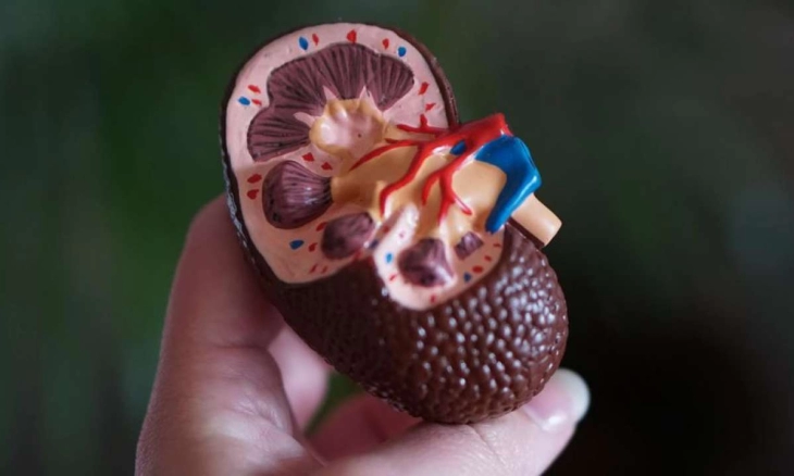 Ginjal Bioartificial Memberikan Harapan Pasien Gagal Ginjal