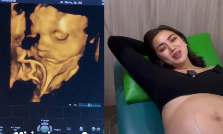 Mikirin Jessica Iskandar Sang Ayah Jatuh Sakit, Ini Kondisinya