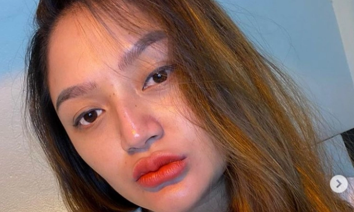 Ditengah Kehamilan 7 Bulan, Siti Badriah Terpapar Covid-19 Varian Omicron