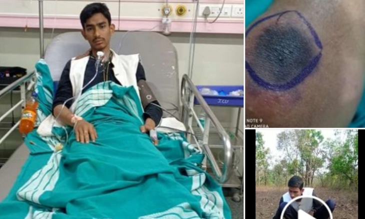 Viral, Pawang Ular Karnataka Atraksi dengan 3 Kobra Berakhir Tragis