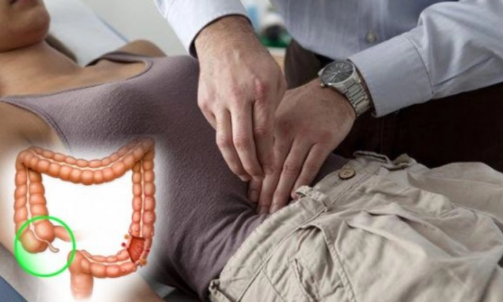 Gejala Kanker Usus: Perut Kembung dan Diare, Jika 3 Pekan Tak Hilang  Segera ke Dokter