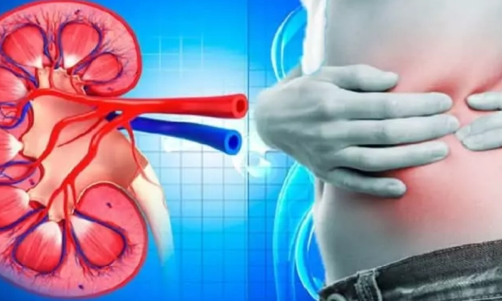 Ini Dia 13 Ciri Penyakit Ginjal, Waspadai Sebelum Terjadi Gagal Ginjal