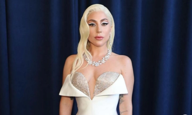 Lady GaGa Jalani Prosedur Permak Wajah dari Mulai Botox, Pasang Benang hingga Suntik neuromodulator 