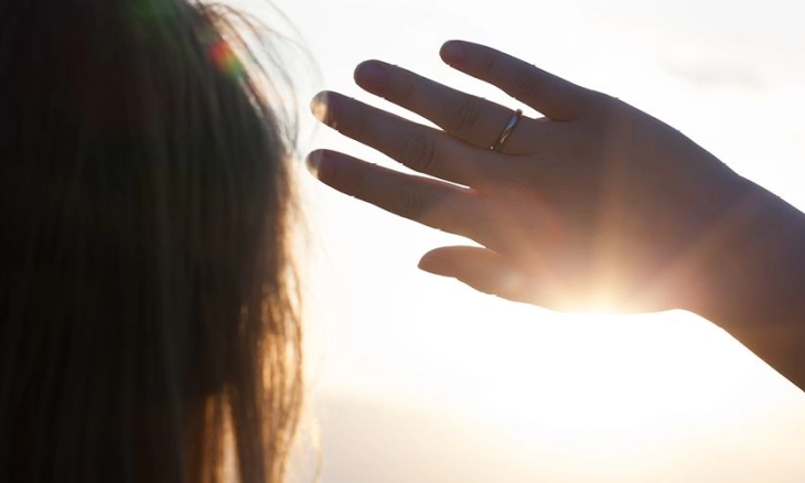 Mengatasi Kulit Terbakar di Rumah Akibat Sinar Matahari