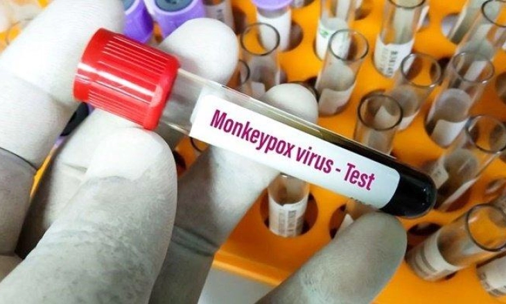 Wabah Cacar Monyet, Masyarakat Diimbau untuk Tidak Panik dan Tetap Waspada