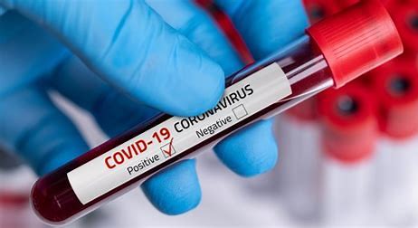 Edukasi Protokol Kesehatan & Vaksinasi Tidak Boleh Berhenti