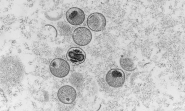 Lebih Dari 1.000 Kasus Cacar Monyet Dilaporkan, WHO Prihatin