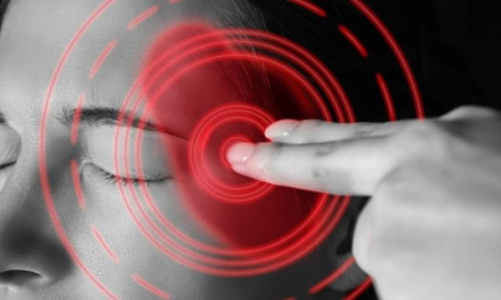 Cara Atasi Migrain dengan Pengobatan Rumahan