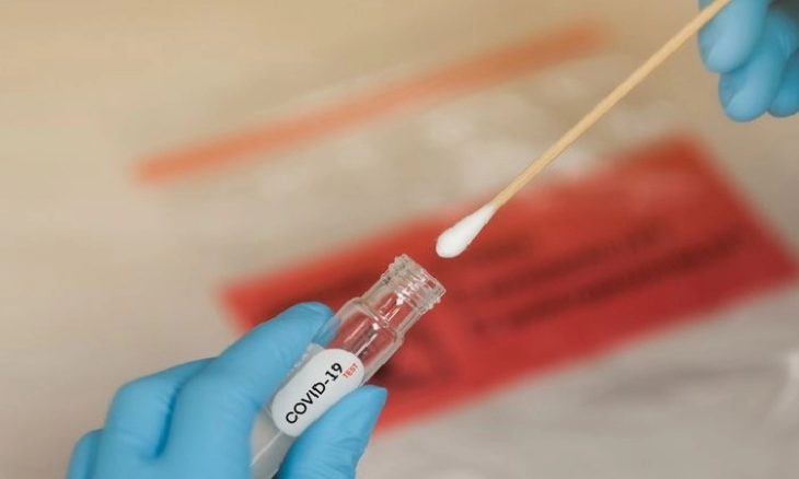 Peneliti Temukan Cara Baru untuk Tes Covid-19 Berbasis Kamera Smartphone