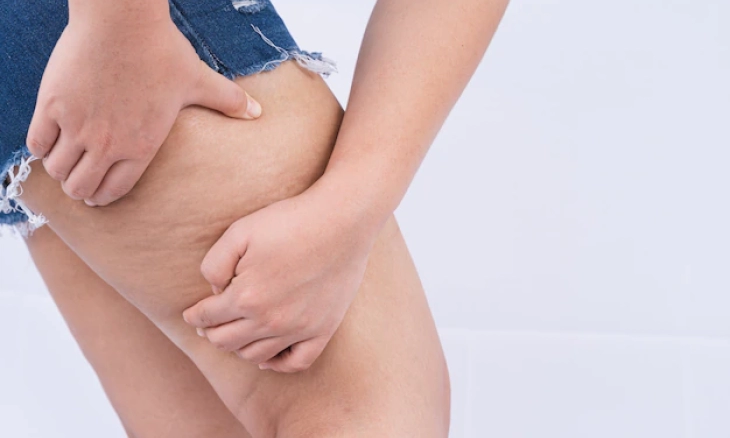 Samarkan Selulit dengan Ampas Kopi