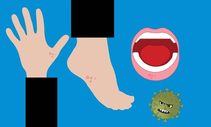 Flu Tomat Sebuah Virus Langka yang Menyerang Anak-anak