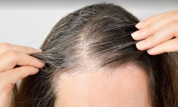 Mencegah Rambut Beruban Prematur Secara Alami