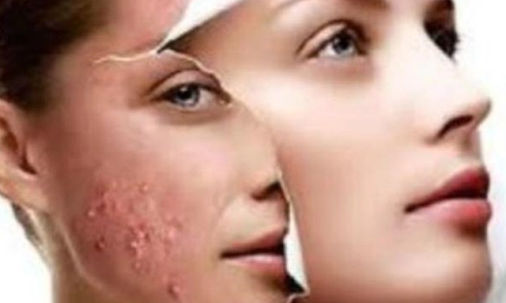 Inilah 5 Manfaat Sperma untuk Kulit Wajah