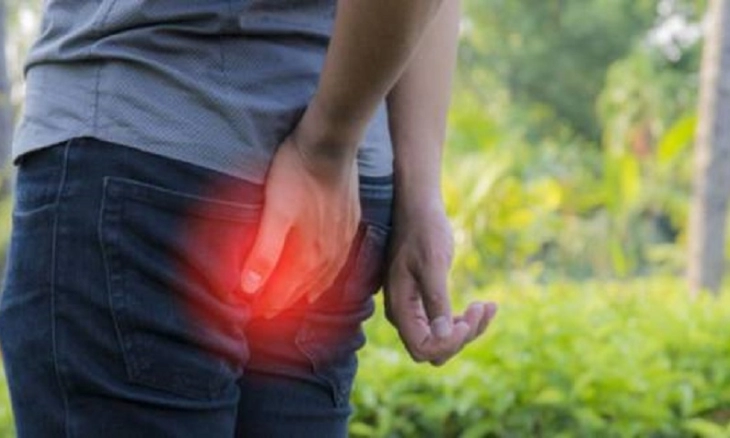 Tips Mencegah dan Mengurangi Penyakit Wasir atau Ambeien